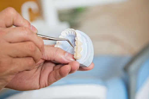 protesi dentale dentisti a rimini bologna