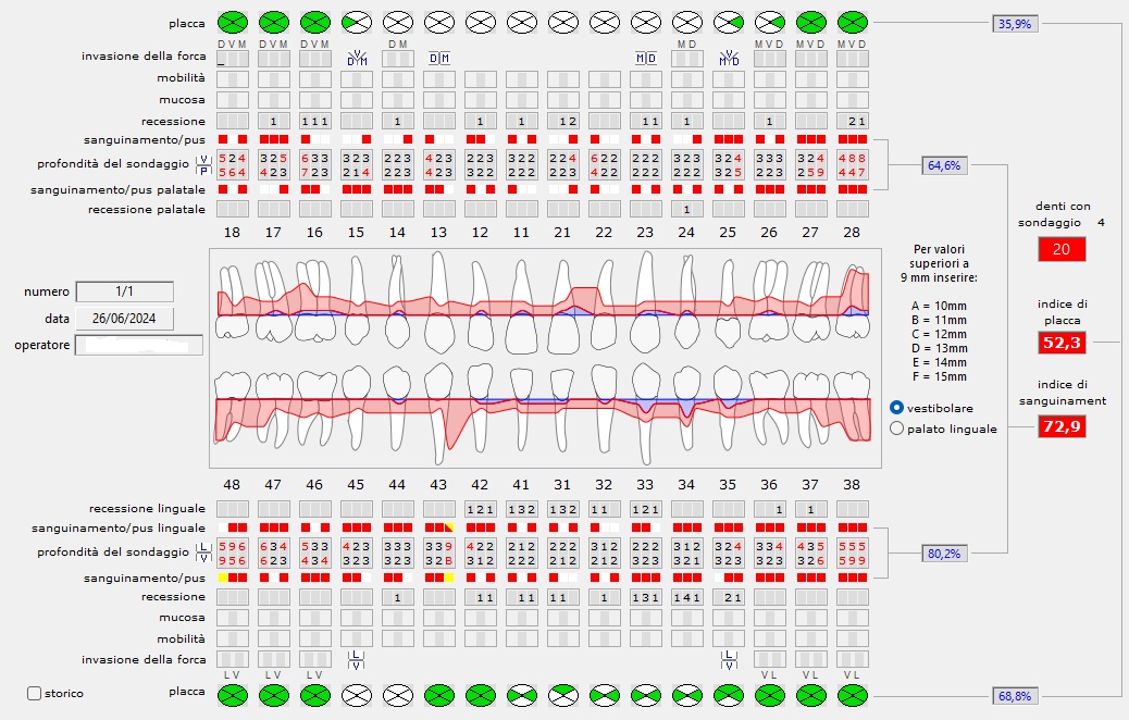 sondaggio parodontale con sonda millimetrata e registrazione cartella parodontale