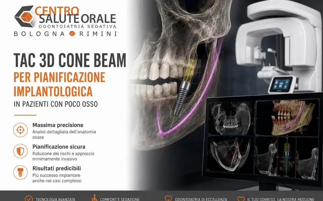 TAC 3D Cone Beam per impianti dentali a Bologna e Rimini: pianificazione implantologica computer-guidata in pazienti con poco osso mediante ricostruzione 3D e analisi anatomica digitale presso Centro Salute Orale.